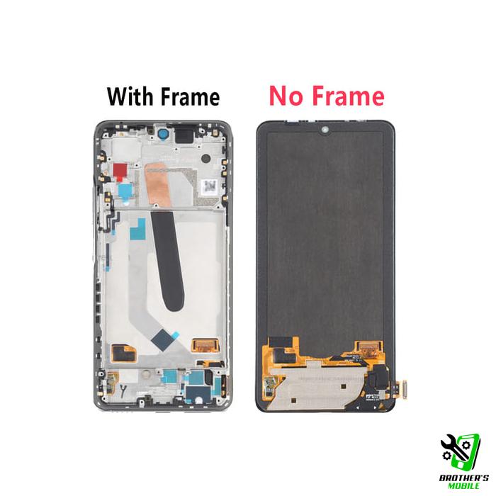 Original Xiaomi 11i Display Price in Bangladesh